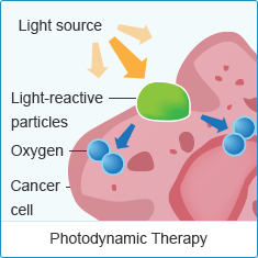 Mesothelioma Cure | Learn More About the Search For a Cure